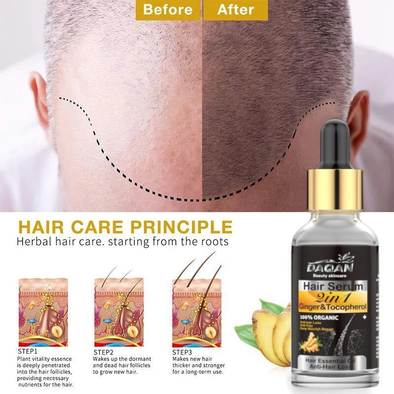 Anti Hair Loss Serum 2 in 1 Natural Hair Fall Serum Ginger and Tocopherol Hair Growth Essence Oil Hair Care Serum | Hair Loss Treatment for Men &amp; Women |